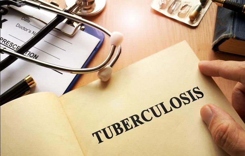 India develops country-level model for estimating TB cases_30.1