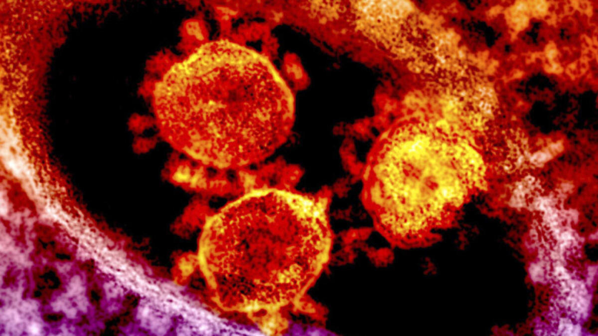 UAE में मिला कोरोनावायरस का नया वेरिएंट, जानें सबकुछ |_20.1