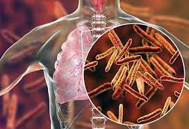 मानवी रोग: रोगांचे वर्गीकरण आणि रोगांचे कारणे | Classification of Diseases and Causes of Diseases_150.1