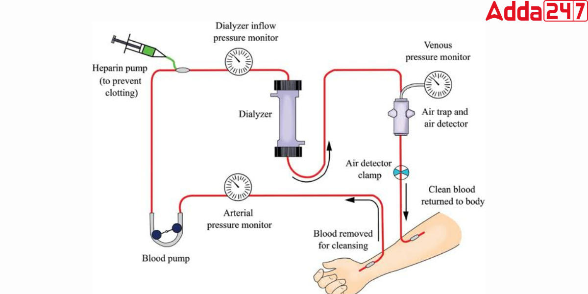 Excretion in Humans, Process, Diagram, System, Function