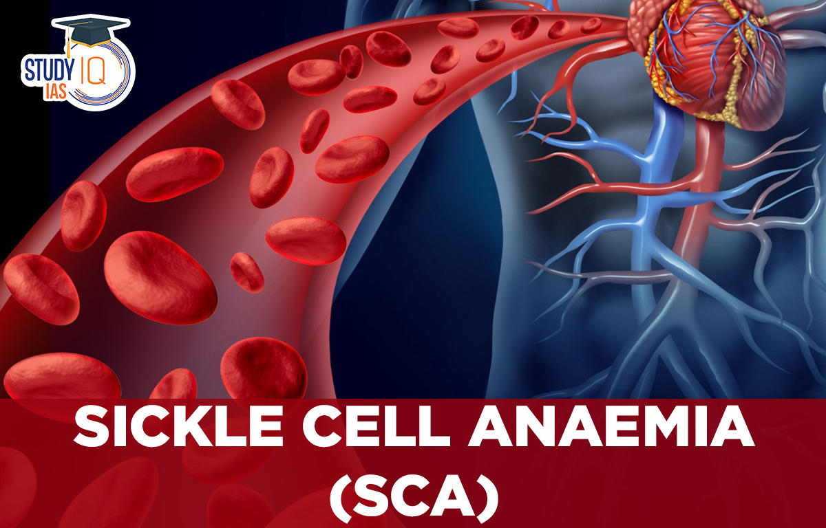 Sickle Cell Anaemia (SCA)