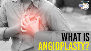 Angioplasty, Types, Procedure, Risks and Recovery