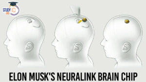 Elon Musk's Neuralink Brain Chip