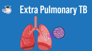 Extra Pulmonary TB