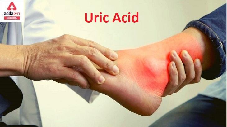 uric acid treatment