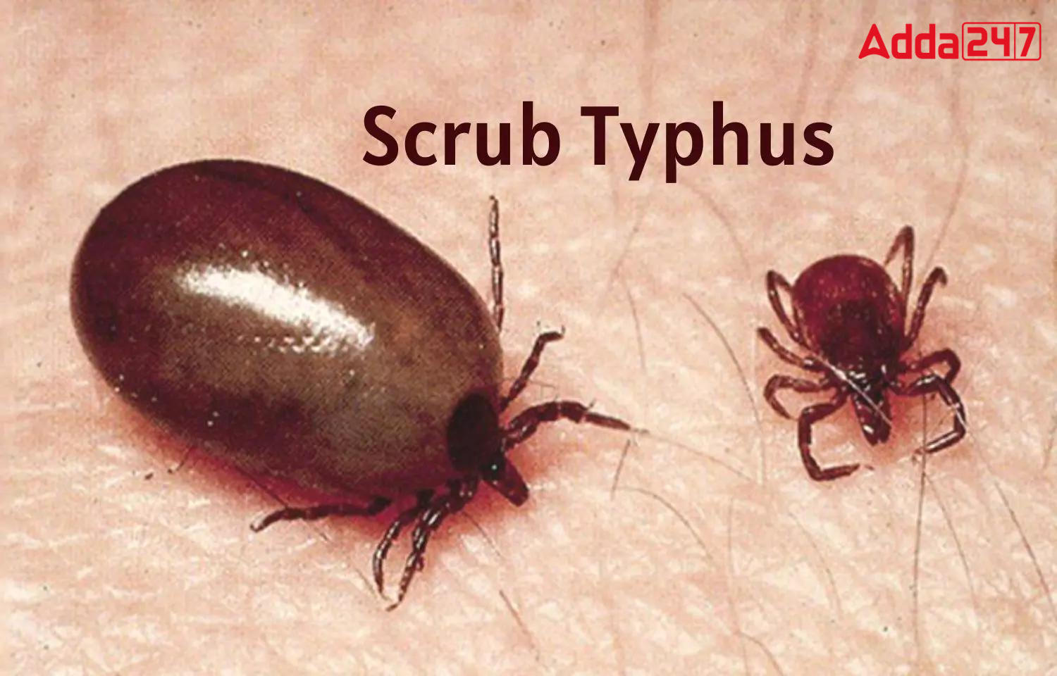 Scrub Typhus: An Overview