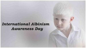 अंतर्राष्ट्रीय एल्बिनिज़्म जागरूकता दिवस: 13 जून |_3.1