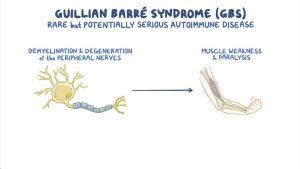 क्या है Guillain-Barre Syndrome? जिसकी वजह से पेरू में लगाई गई है हेल्थ इमरजेंसी |_3.1