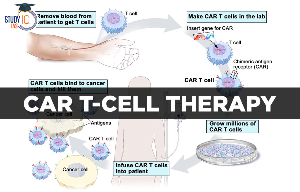 CAR T-Cell therapy