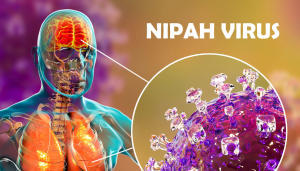 Why Is Nipah Virus In News?_5.1