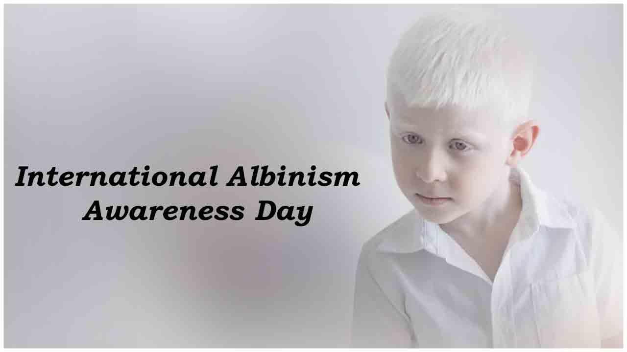 International Albinism Awareness Day: 13 June | आंतरराष्ट्रीय अल्बनिझम जागृती दिन: 13 जून_2.1