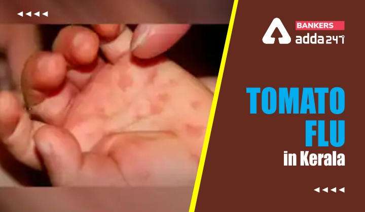 Tomato Flu in Kerala: What is Tomato Flu? Symptoms, Treatment and Precautions_40.1