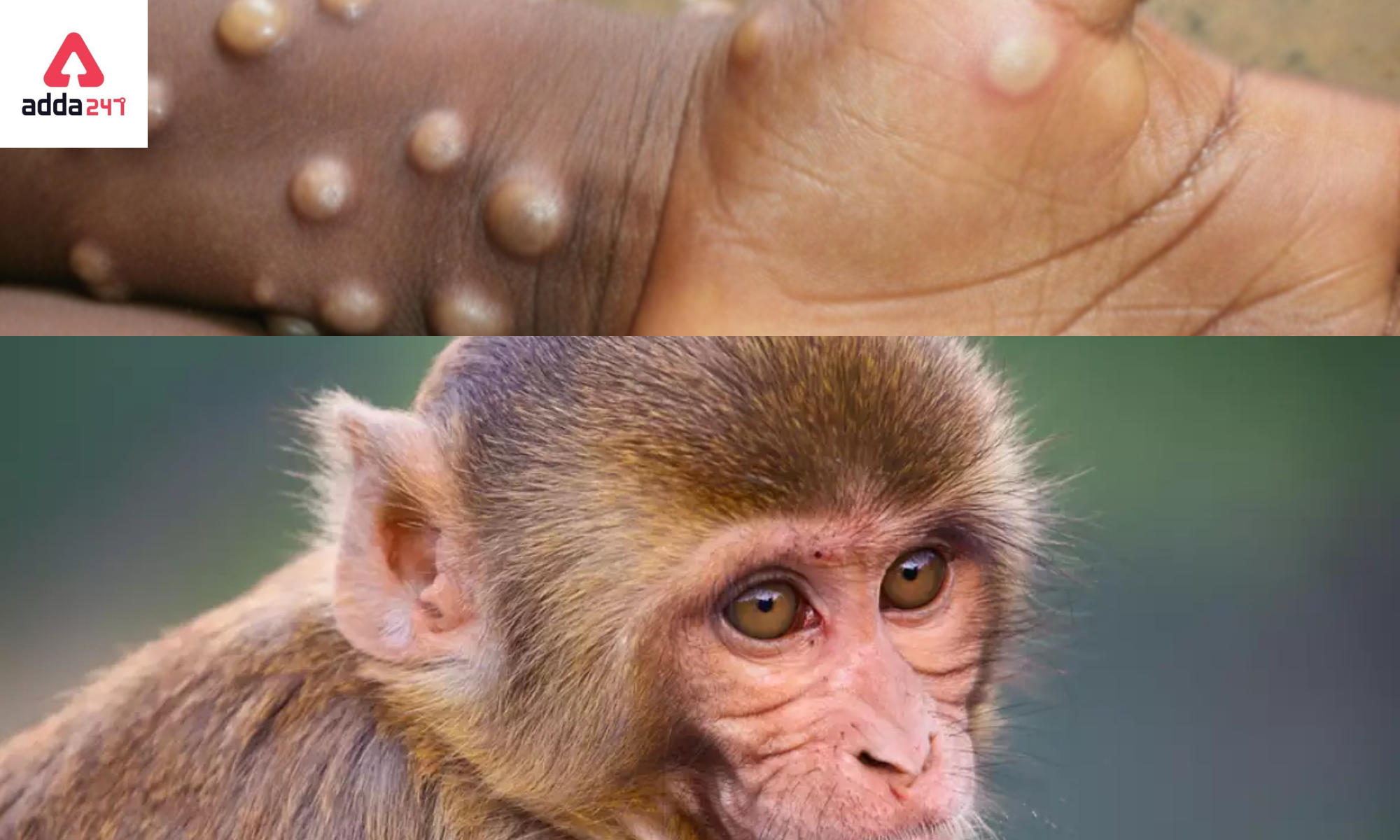 Monkeypox Virus : History, Outbreak, Symptoms Virus 2022_40.1