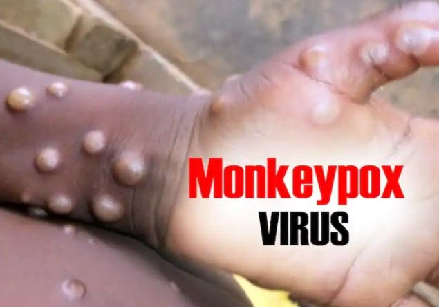 India's first Monkeypox case reported in Kerala_40.1