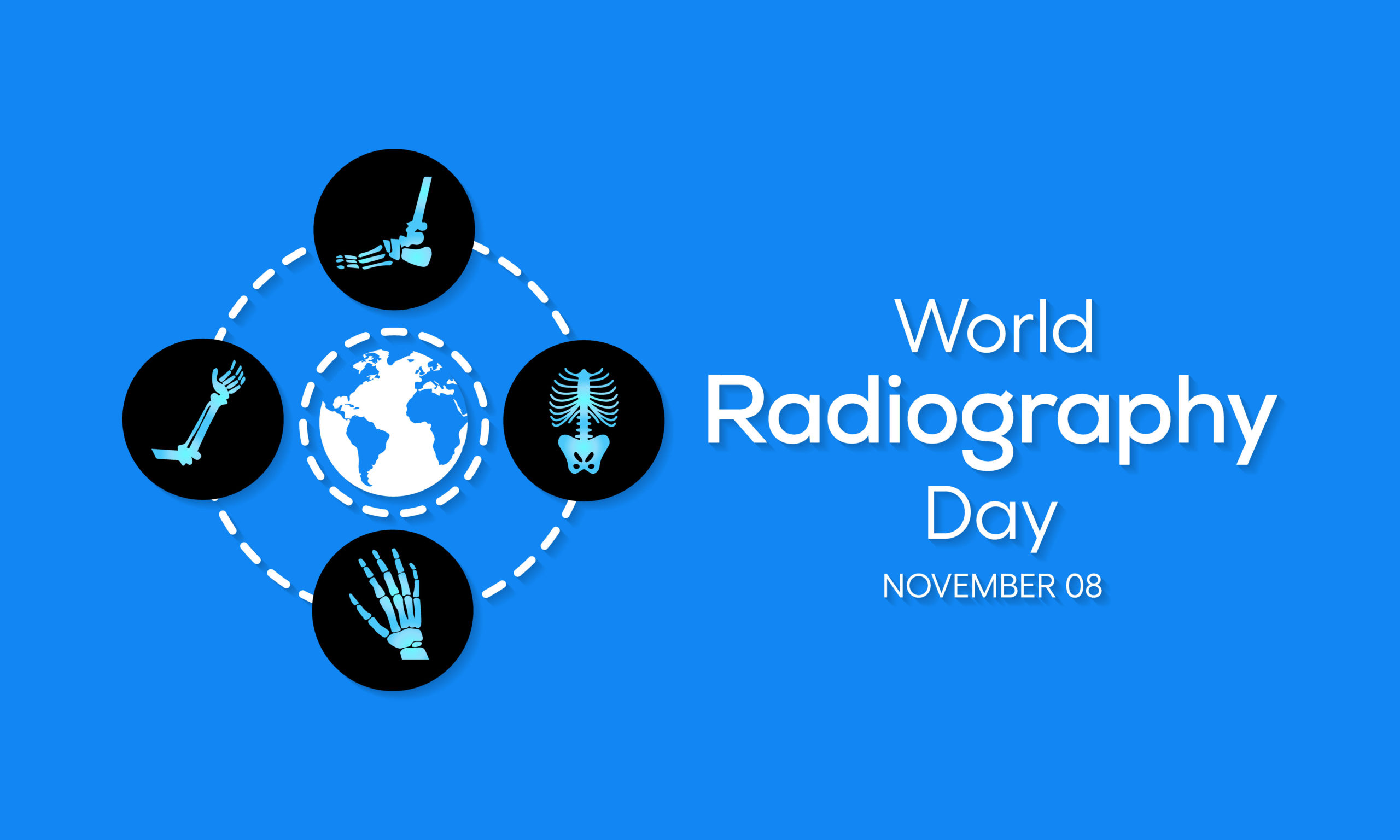 World Radiography Day 2022: Theme, Significance and History_40.1