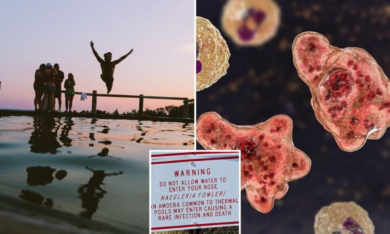 Brain-eating amoeba infection reported in South Korea
