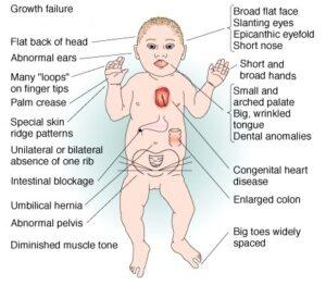 मानवी रोग: रोगांचे वर्गीकरण आणि रोगांचे कारणे | Classification of Diseases and Causes of Diseases_27.1