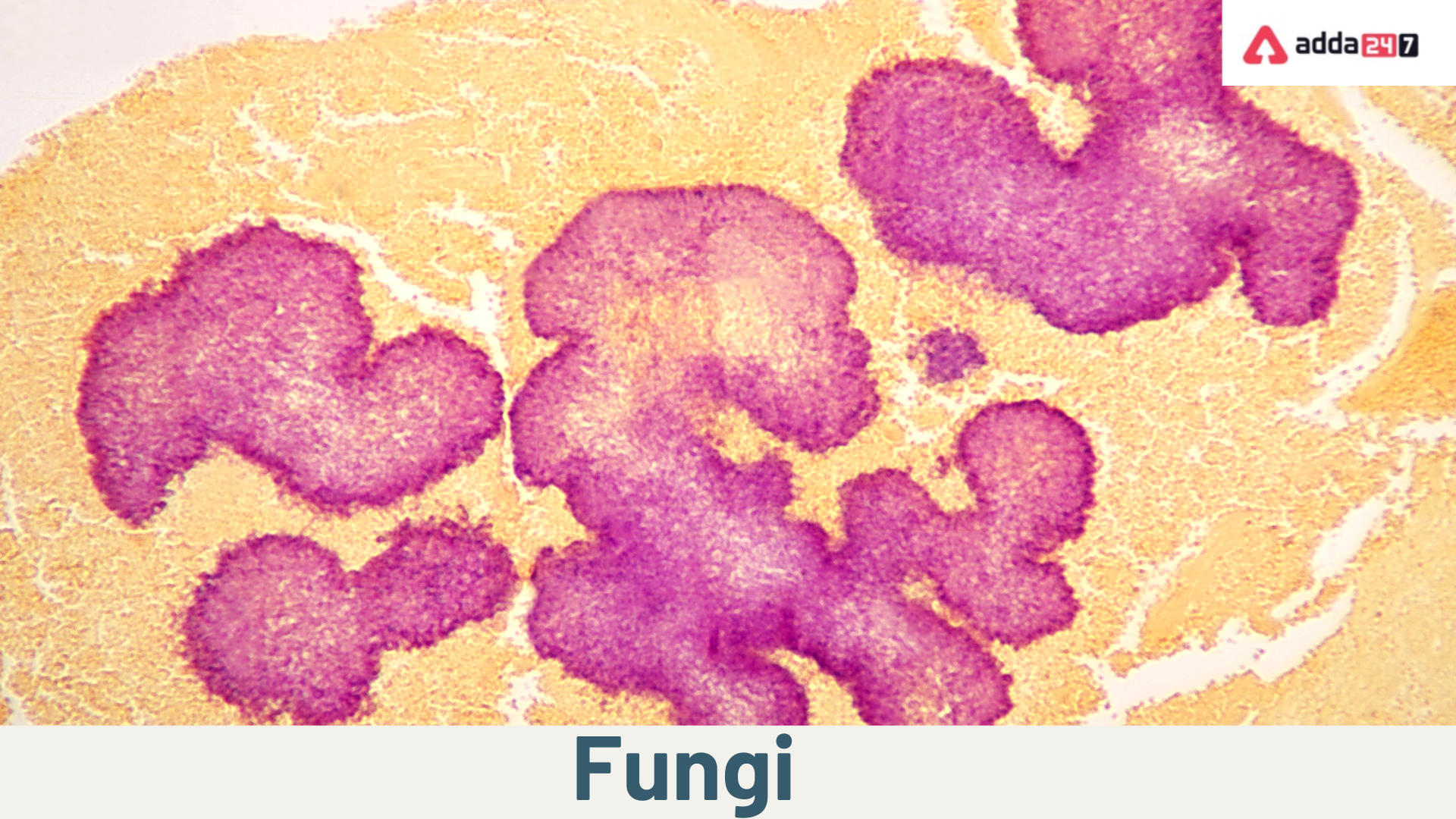 What Is Fungi :Structure,characteristics