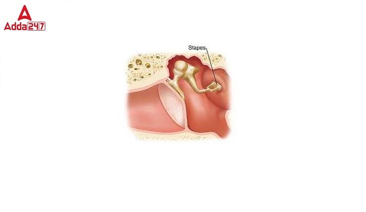 Which is the smallest bone in the human body?