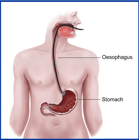 Difference Between Esophagus and Trachea_3.1