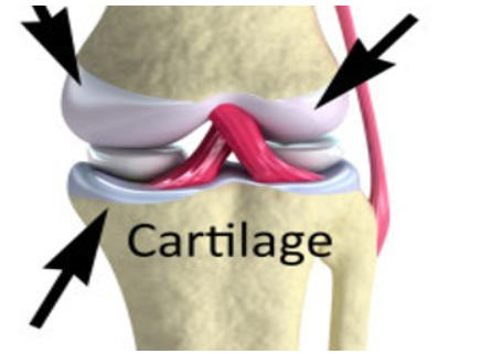 Difference Between Bone and Cartilage_40.1