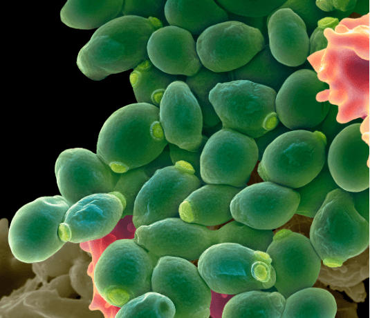 Molds and Yeasts - Difference and Comparison_4.1