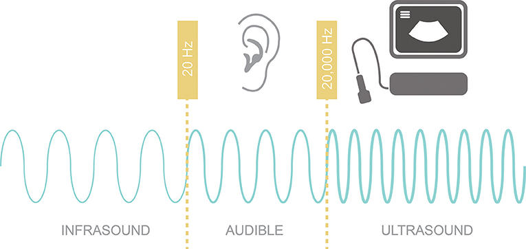 Figure 1 - Different sound frequencies: infrasound has sound waves with frequencies lower than 20 Hz; audible sound, which has sound waves with frequencies between 20 and 20,000 Hz; and ultrasound, which has sound waves with frequencies >20,000 Hz.