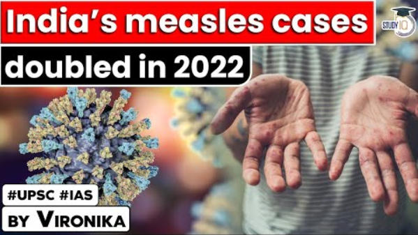 measles