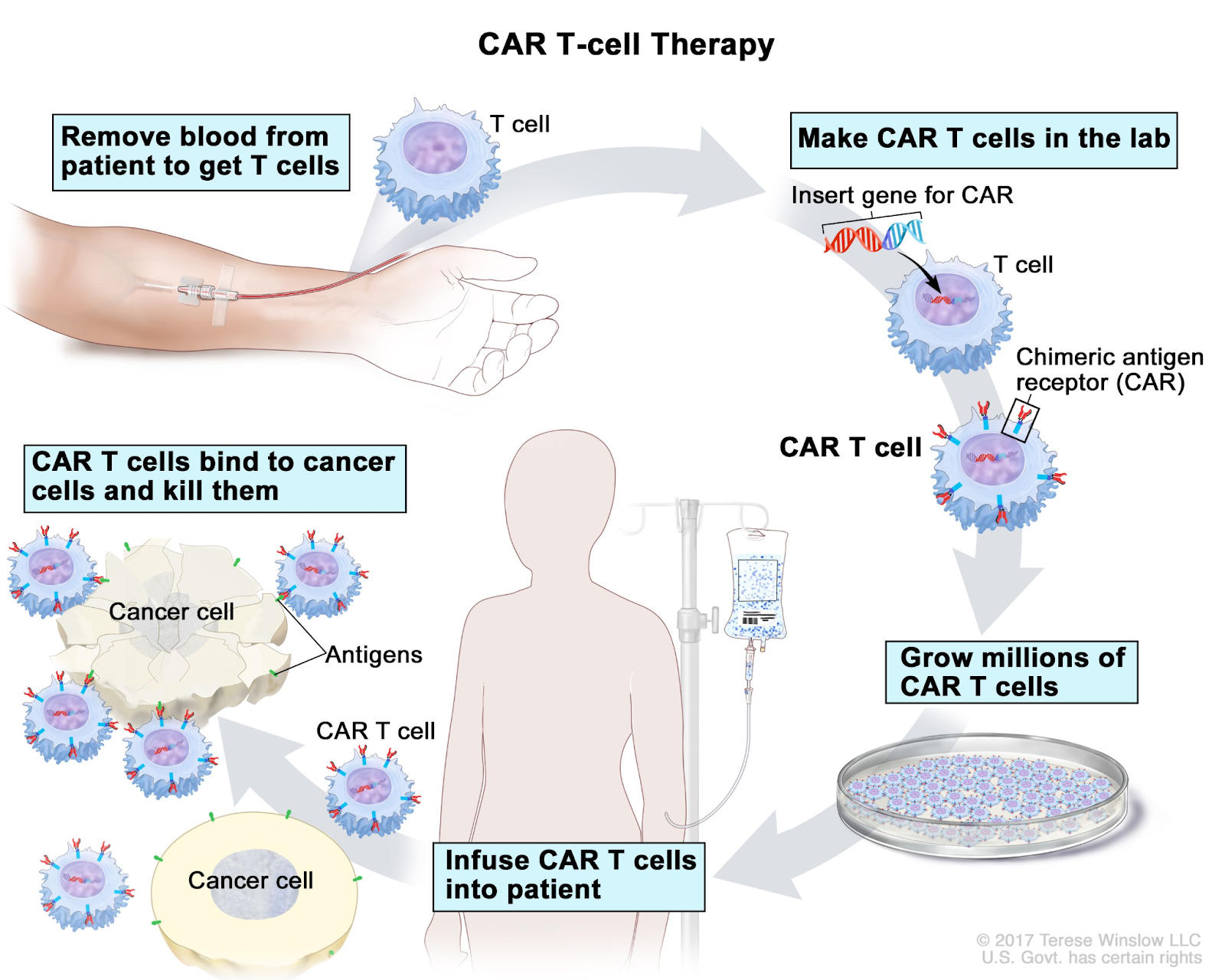 (CAR) T Cell Therapy