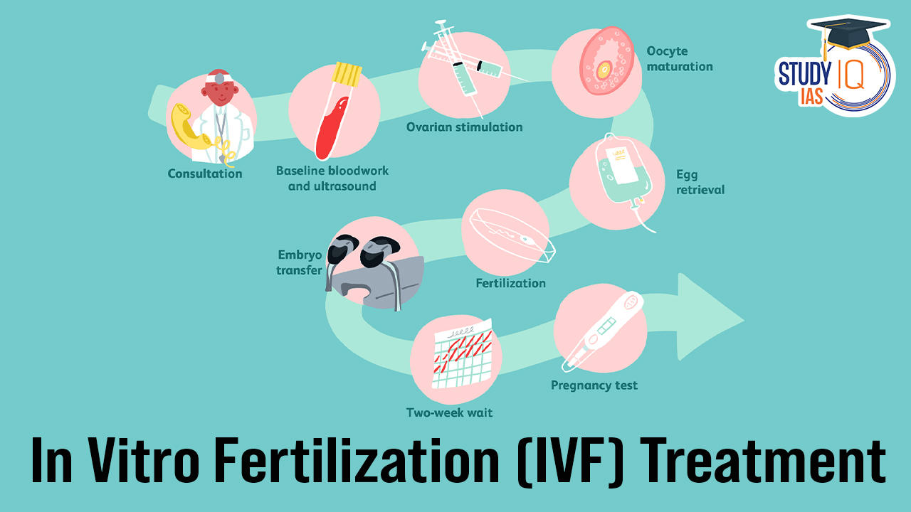 In vitro fertilization (IVF) Treatment.