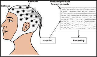 What is Electroencephalography (EEG)?_4.1